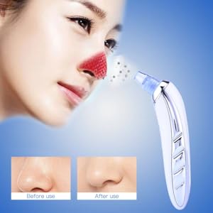 Kemei-KM-1868-Electronic-Blackhead-and-Facial-Pore-Cleaner-rlm